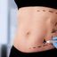 Liposuction in Riyadh
