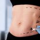 Liposuction in Riyadh
